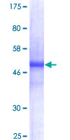12.5% SDS-PAGE Stained with Coomassie Blue.